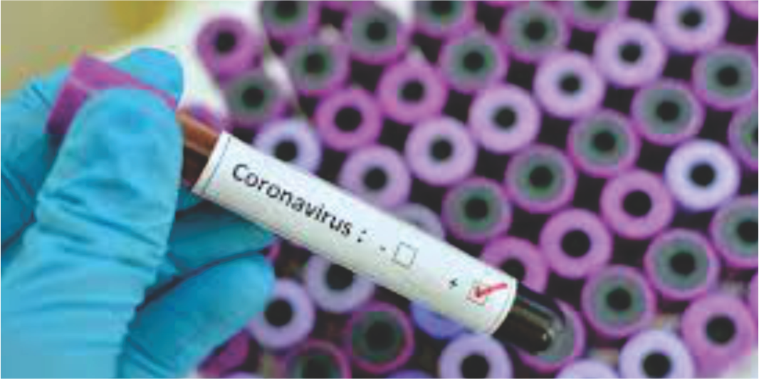 corona-virus-como-sua-empresa-deve-se-preparar